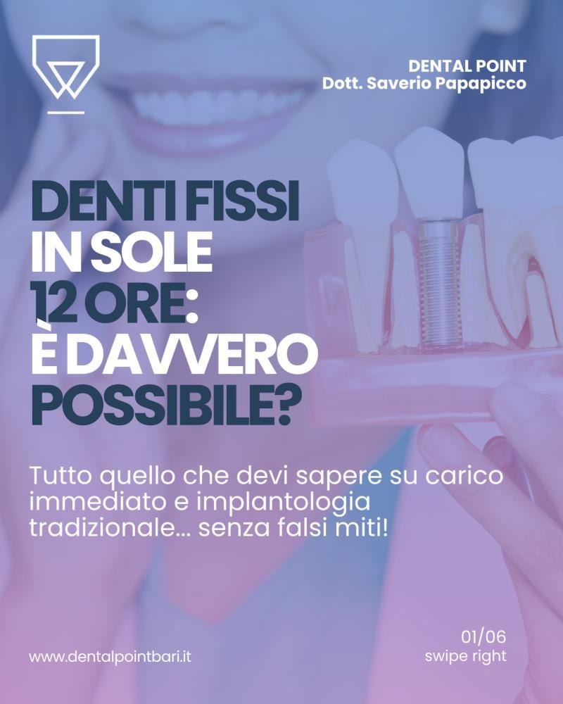 Denti fissi in 12 ore